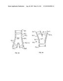 STENT/GRAFT ASSEMBLY diagram and image