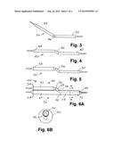 BIFURCATED DUAL-BALLOON CATHETER SYSTEM FOR BIFURCATED VESSELS diagram and image