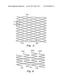 CONTROLLED FRACTURE CONNECTIONS FOR STENTS diagram and image