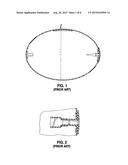 Intragastric Balloon System diagram and image