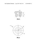 Method of Implanting an Intragastric Balloon diagram and image