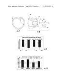 CRANIAL POSITION ORIENTATION DETECTION METHOD AND APPARATUS FOR PEDIATRIC     PATIENTS diagram and image