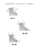 TRANSFORMABLE ORTHOPEDIC BRACE FOR INJURY PREVENTION diagram and image