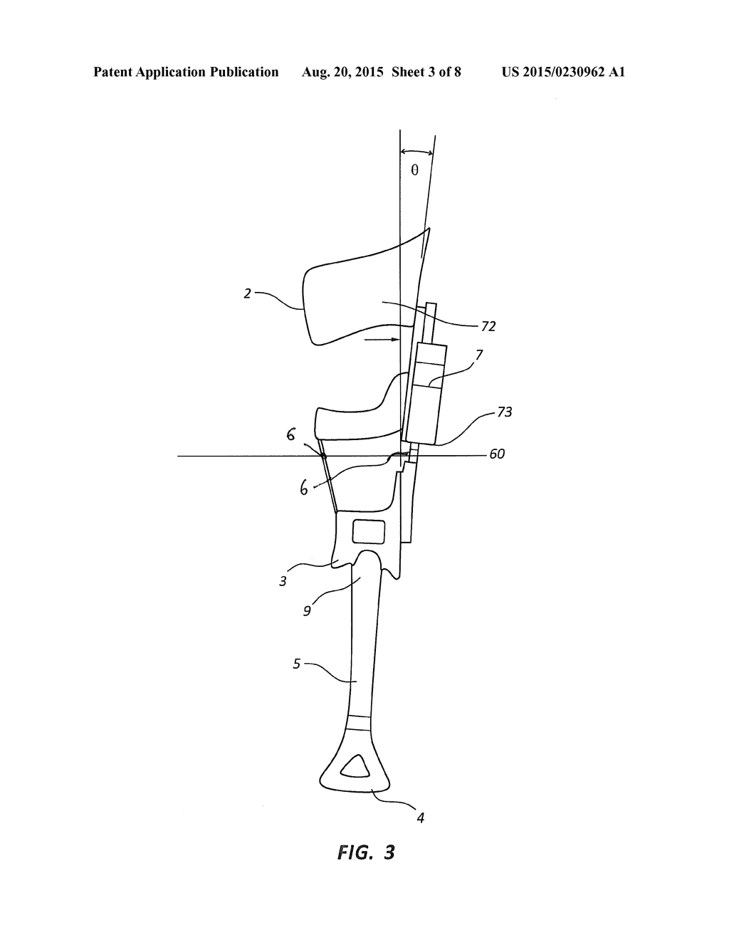 METHOD FOR CONTROLLING A KNEE ORTHOSIS - diagram, schematic, and image 04