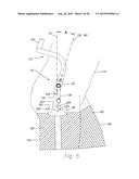 Trunk Supporting Exoskeleton and Method of Use diagram and image