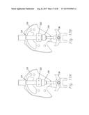 Trunk Supporting Exoskeleton and Method of Use diagram and image