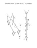 Nasal Dilator diagram and image