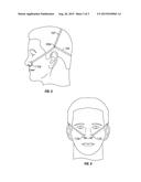 Nasal Dilator diagram and image