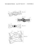 Nasal Dilator with Decorative Design Element diagram and image