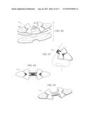 Nasal Dilator with Decorative Design Element diagram and image