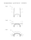 DEFORMED NAIL CORRECTOR diagram and image