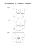 DEFORMED NAIL CORRECTOR diagram and image