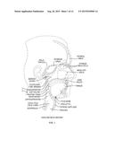 Nasopharyngeal Device for Obstructive Sleep Apnea Syndrome diagram and image