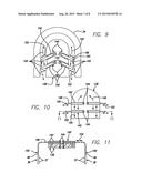 Dental Sleep Apnea Device diagram and image