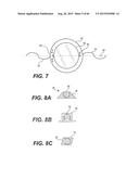 MODULAR INTRAOCULAR LENS DESIGNS, TOOLS AND METHODS diagram and image