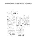 MODULAR INTRAOCULAR LENS DESIGNS, TOOLS AND METHODS diagram and image