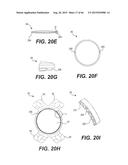 MODULAR INTRAOCULAR LENS DESIGNS, TOOLS AND METHODS diagram and image