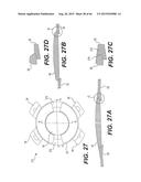 MODULAR INTRAOCULAR LENS DESIGNS, TOOLS AND METHODS diagram and image