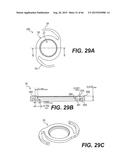 MODULAR INTRAOCULAR LENS DESIGNS, TOOLS AND METHODS diagram and image