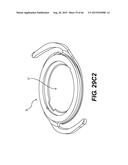 MODULAR INTRAOCULAR LENS DESIGNS, TOOLS AND METHODS diagram and image