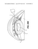 MODULAR INTRAOCULAR LENS DESIGNS, TOOLS AND METHODS diagram and image