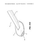 MODULAR INTRAOCULAR LENS DESIGNS, TOOLS AND METHODS diagram and image