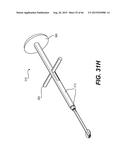 MODULAR INTRAOCULAR LENS DESIGNS, TOOLS AND METHODS diagram and image