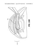 MODULAR INTRAOCULAR LENS DESIGNS, TOOLS AND METHODS diagram and image