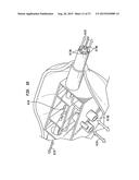 External Ear Canal Pressure Regulation System diagram and image