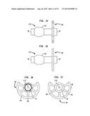 External Ear Canal Pressure Regulation System diagram and image