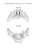 External Ear Canal Pressure Regulation System diagram and image