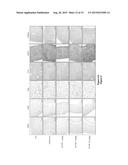 USAGE OF GUTTIFERONE K FOR TREATING HIGH METASTATIC CANCER diagram and image