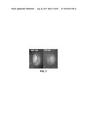 TARGETING PRIMARY CILIA TO TREAT GLAUCOMA diagram and image