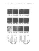 TRABECULAR MESHWORK STEM CELLS diagram and image