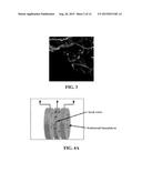 CELL SYSTEMS AND METHODS FOR DELIVERING DISEASE-SPECIFIC THERAPIES diagram and image