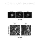 CELL SYSTEMS AND METHODS FOR DELIVERING DISEASE-SPECIFIC THERAPIES diagram and image