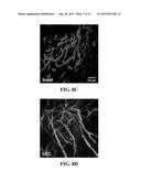 CELL SYSTEMS AND METHODS FOR DELIVERING DISEASE-SPECIFIC THERAPIES diagram and image