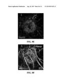 CELL SYSTEMS AND METHODS FOR DELIVERING DISEASE-SPECIFIC THERAPIES diagram and image