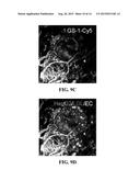 CELL SYSTEMS AND METHODS FOR DELIVERING DISEASE-SPECIFIC THERAPIES diagram and image