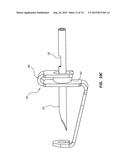 Catheter Placement Device Including Guidewire and Catheter Control     Elements diagram and image