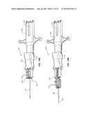 Catheter Placement Device Including Guidewire and Catheter Control     Elements diagram and image