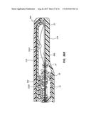 Catheter Placement Device Including Guidewire and Catheter Control     Elements diagram and image