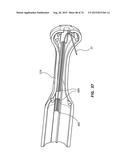 Catheter Placement Device Including Guidewire and Catheter Control     Elements diagram and image