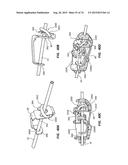 Catheter Placement Device Including Guidewire and Catheter Control     Elements diagram and image