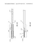 Catheter Placement Device Including Guidewire and Catheter Control     Elements diagram and image