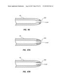 Catheter Placement Device Including Guidewire and Catheter Control     Elements diagram and image