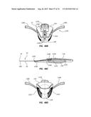 Catheter Placement Device Including Guidewire and Catheter Control     Elements diagram and image