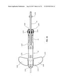 Catheter Placement Device Including Guidewire and Catheter Control     Elements diagram and image