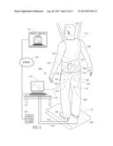 Neurostimulator diagram and image