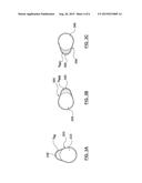 Melt Channel Geometries for an Injection Molding System diagram and image